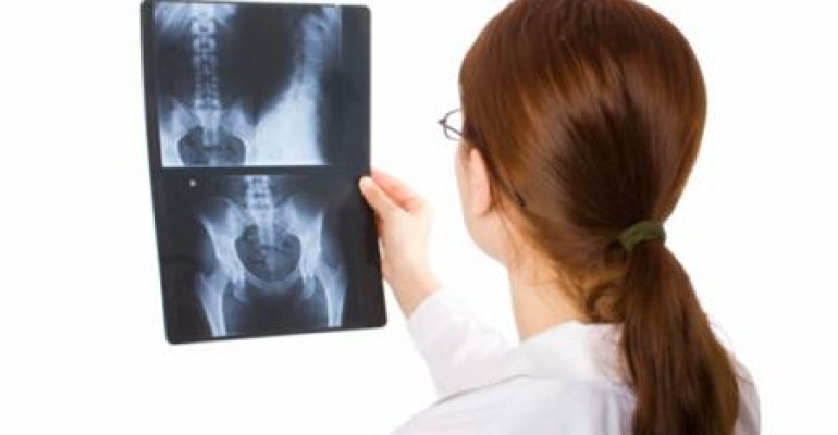 MESE DELLA PREVENZIONE: 10 DOMANDE SULL’OSTEOPOROSI