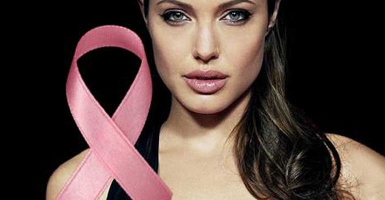 Effetto Jolie: l’importanza del test BRCA