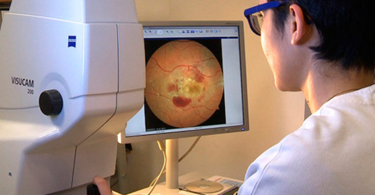 Retinopatia diabetica: un nuovo dispositivo per la diagnosi