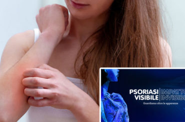 PsoPoint, la piattaforma che connette dermatologi e pazienti con psoriasi