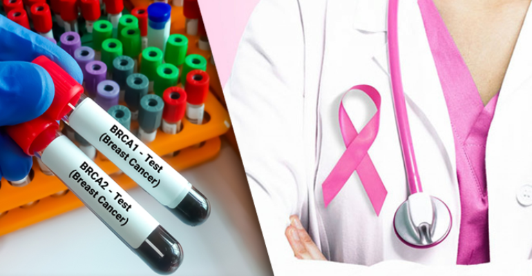 Tumori con mutazione BRCA: l’importanza dei test per identificarli