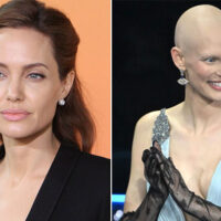 Angelina Jolie e Bianca Balti: donne coraggiose, contro i tumori genetici