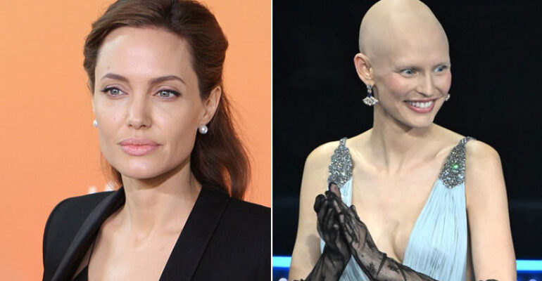 Angelina Jolie e Bianca Balti: donne coraggiose, contro i tumori genetici